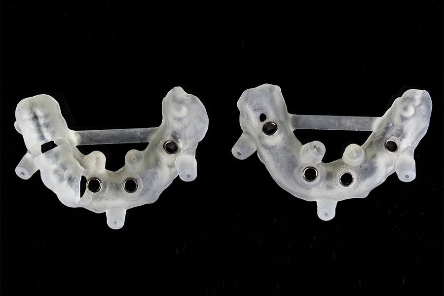 サージカルガイド作成